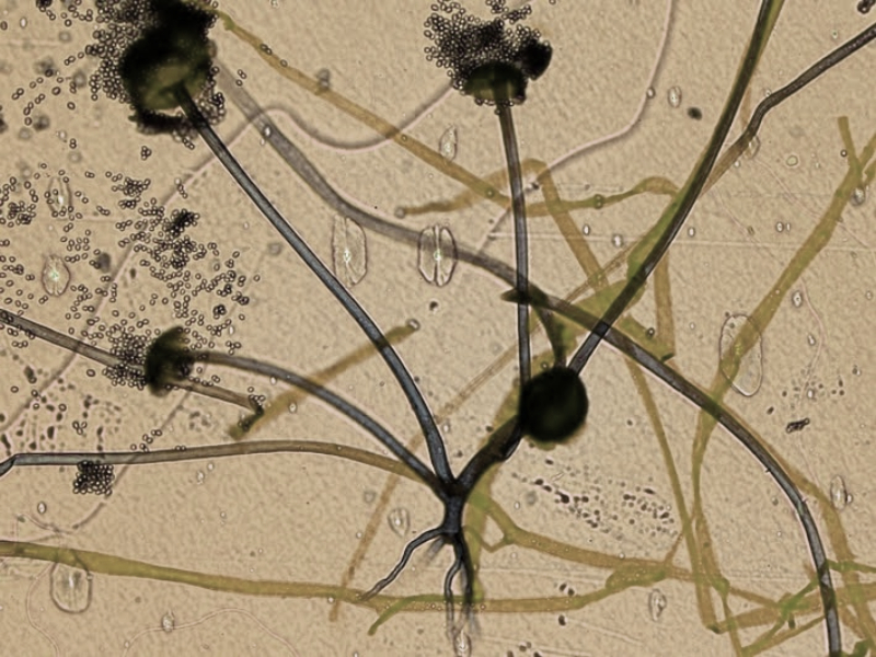 Rhizopus oryzae bakteri pada pembuatan Tempe