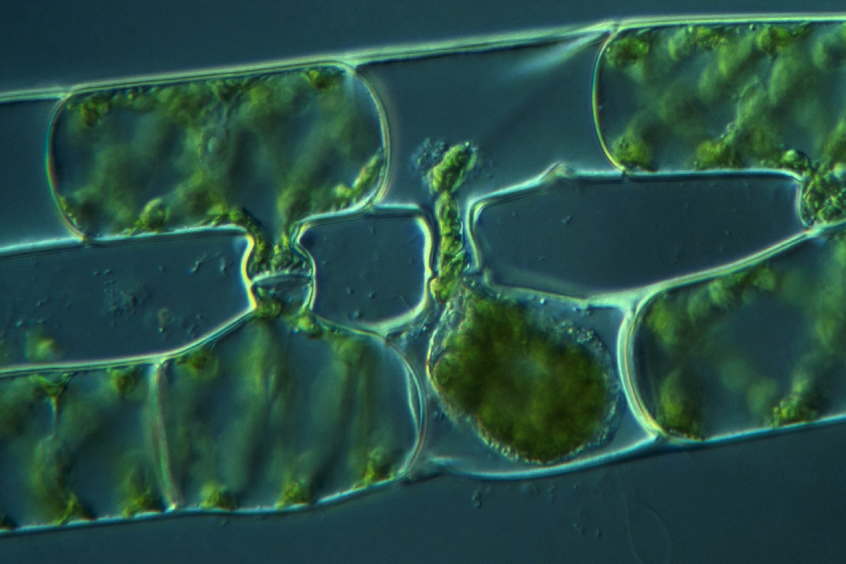 Praktikum Biologi Pengamatan Sel Tumbuhan