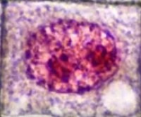 Metafase Pembelajaran Sel Mitosis Sel Bawang
