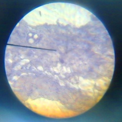 Epitel gepeng berlapis dengan kreatin pada kulit telapak kaki Di bawah Mikroskop