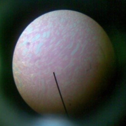 Epitel gepeng selapis Perbesaran 10 Kali