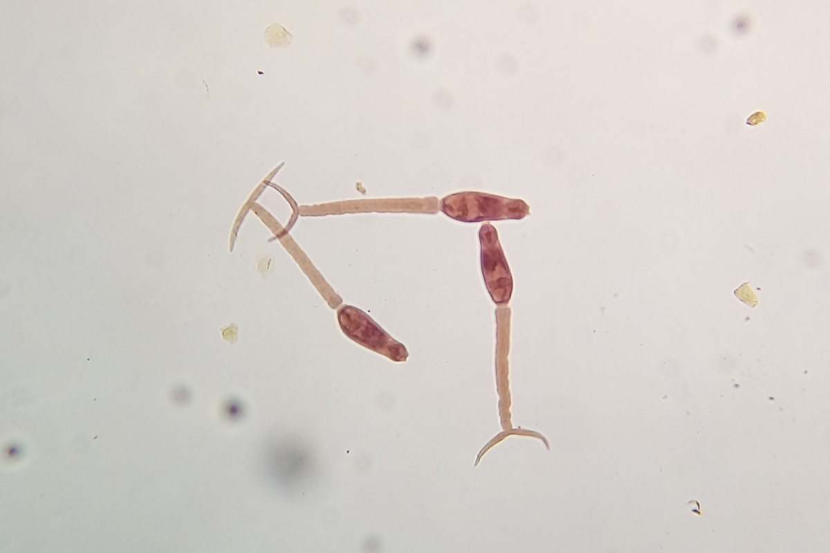 Praktikum Cacing Trematoda pada Keong