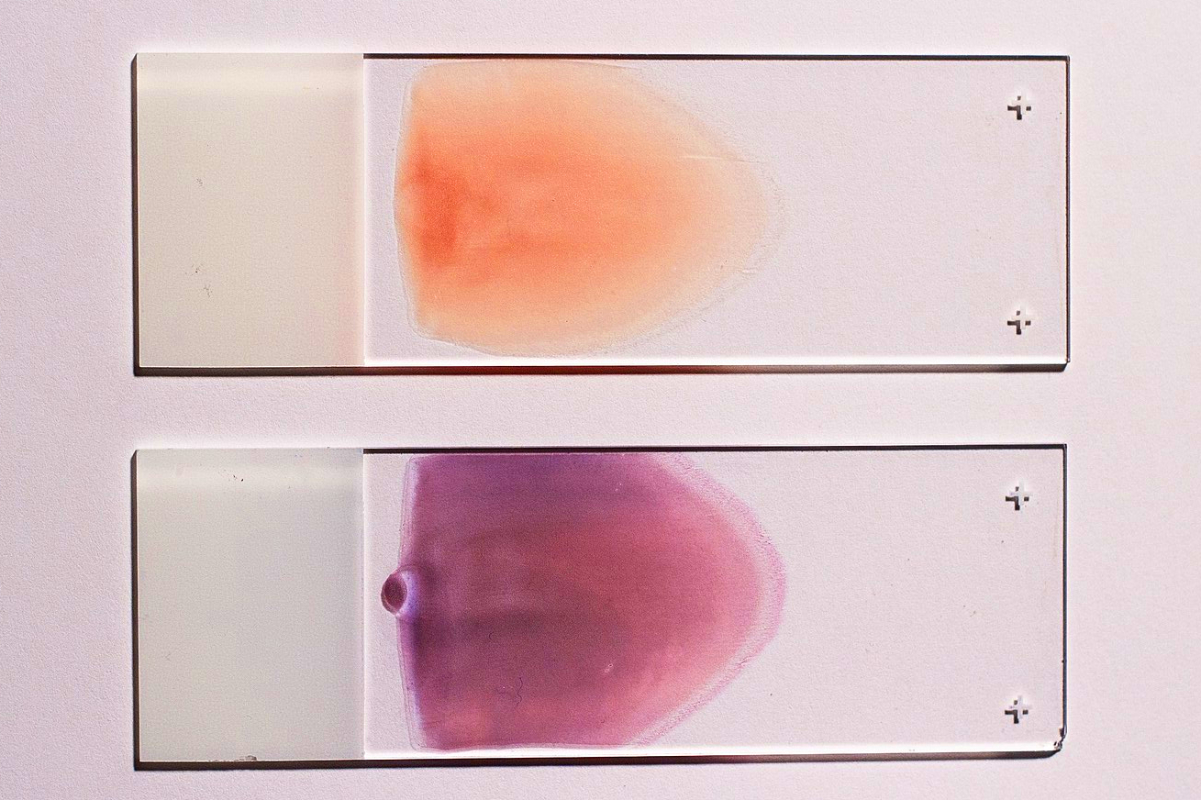 Laporan Praktikum Histologi – Pembuatan Preparat Apus Darah Manusia